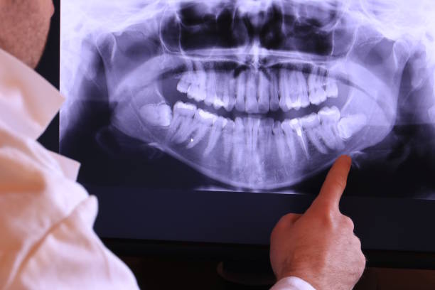 Best Broken Tooth Emergency  in Netcong, NJ